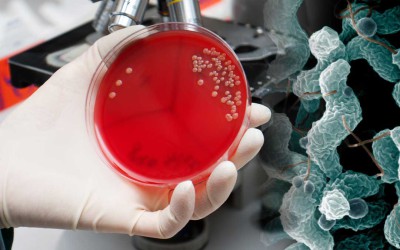 Mikrobiologiczna (bakteriologiczna) analiza wody