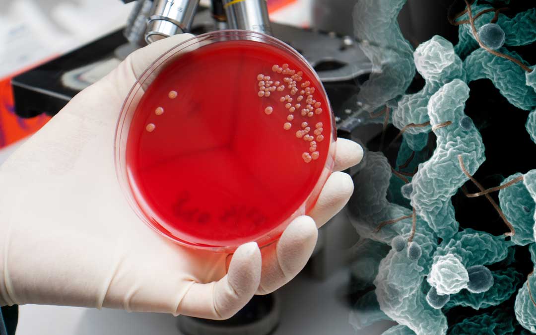 Mikrobiologiczna (bakteriologiczna) analiza wody