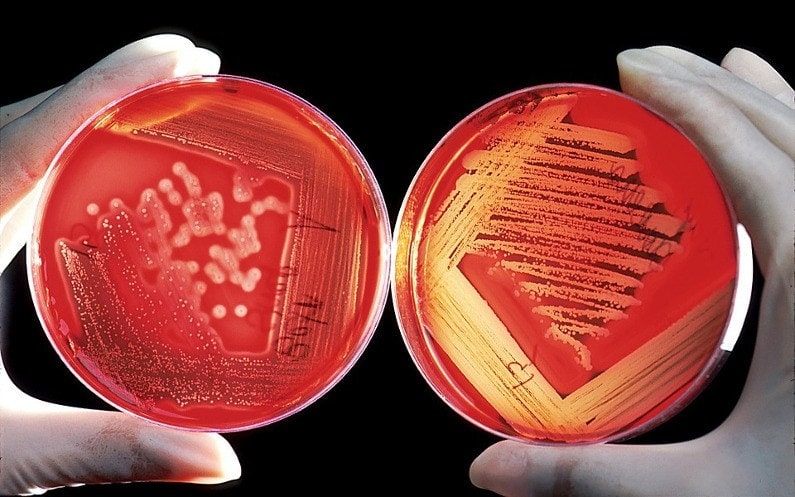 Bakteria legionella w domowej instalacji!